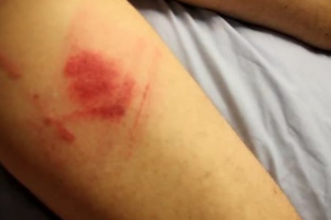 Spanking